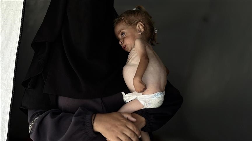 والدة الطفلة شام أنجبتها بعد 9 سنوات من التعب والعلاج واليوم أخشى أن أفقدها